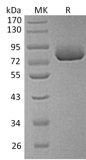 Recombinant Human SPP1 (C-6His)