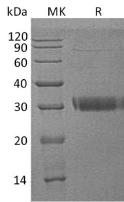 Recombinant Human Acrp30 (C-6His)