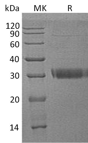Recombinant Human Acrp30 (C-6His)