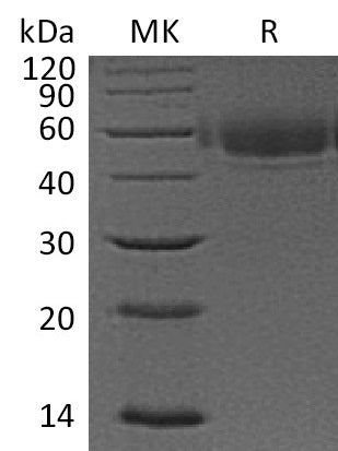 Recombinant Human VSIG4 (C-6His)