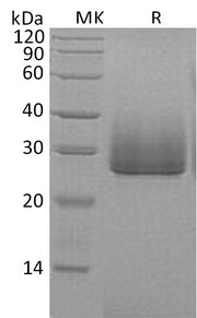Recombinant Human ApoD (C-6His)