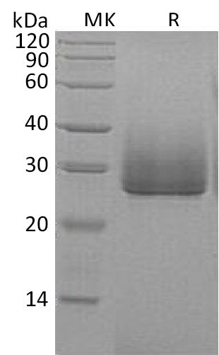 Recombinant Human ApoD (C-6His)