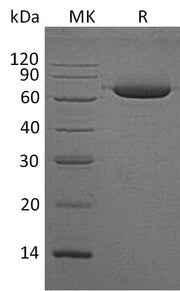 Recombinant Human ALPL (C-6His)