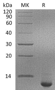 Recombinant Human SPINK4 (C-6His)