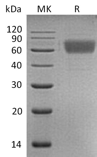 Recombinant Human AMIGO2 (C-6His)
