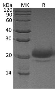 Recombinant Human WFDC2 (C-6His)