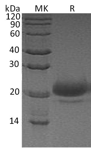 Recombinant Human WFDC2 (C-6His)