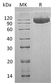 Recombinant Human Serpin G1 (C-6His)