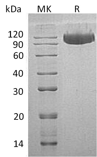 Recombinant Human Serpin G1 (C-6His)