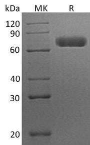 Recombinant Human EphA7 (C-6His)