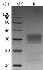 Recombinant Human NKG2DL2 (C-6His)