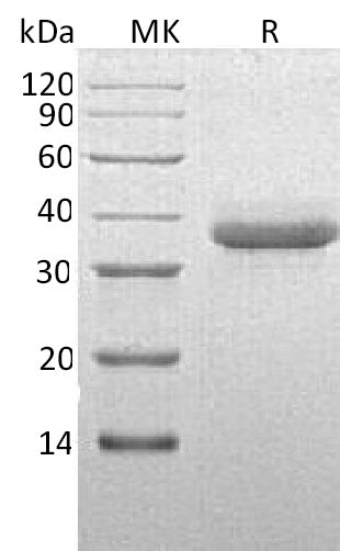 Recombinant Human CTRC (C-6His)