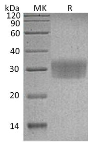 Recombinant Human CD7 (C-6His)