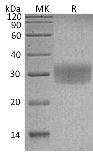 Recombinant Human CD7 (C-6His)