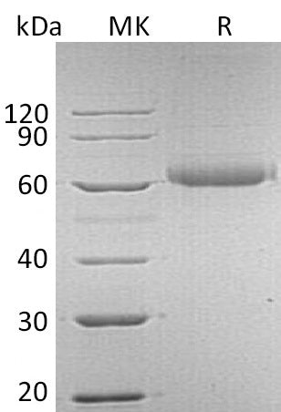 Recombinant Human FGFRL1 (C-6His)
