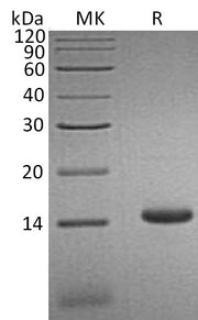 Recombinant Human CCL3L1 (C-6His)