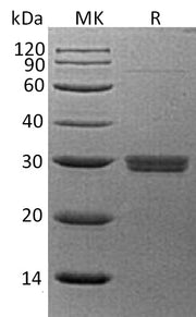 Recombinant Human SAP (C-6His)