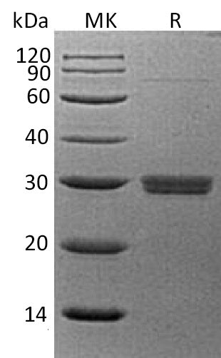 Recombinant Human SAP (C-6His)
