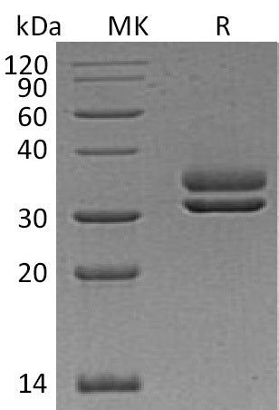 Recombinant Human CFHR2 (C-6His)