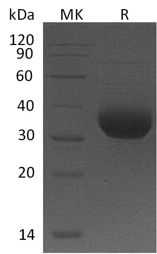 Recombinant Human BTN1A1 (C-6His)