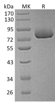 Recombinant Human XPNPEP2 (C-6His)
