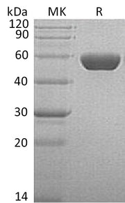 Recombinant Human Serpin A1 (C-6His)