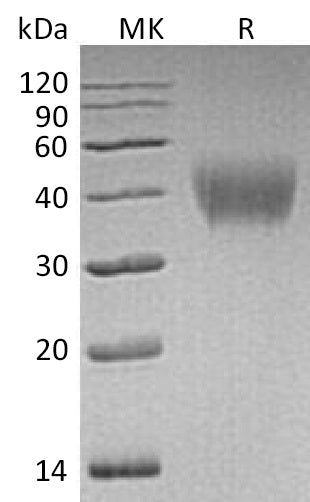 Recombinant Human HepaCAM (C-6His)