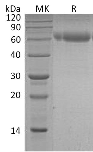 Recombinant Human Serpin A7 (C-6His)