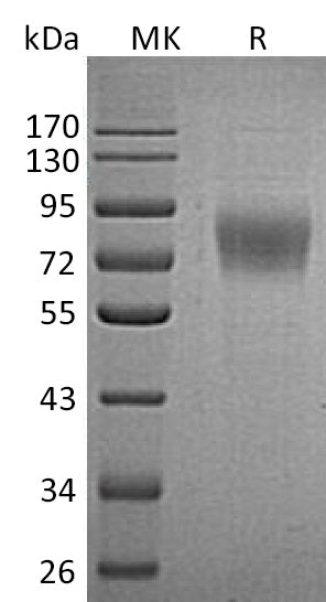 Recombinant Human PLXDC1 (C-6His)
