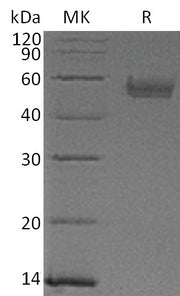 Recombinant Human Serpin A5 (C-6His)