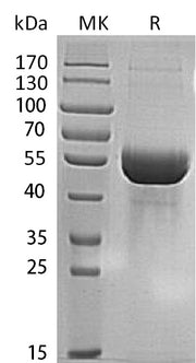 Recombinant Human MINPP1 (C-6His)