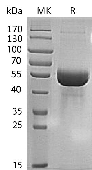 Recombinant Human MINPP1 (C-6His)