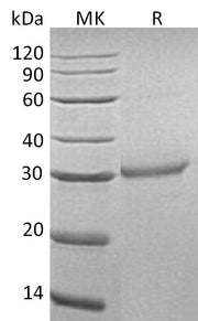 Recombinant Human OLR1 (C-6His)