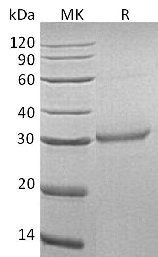 Recombinant Human OLR1 (C-6His)