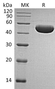 Recombinant Human Serpin E1 (C-6His)