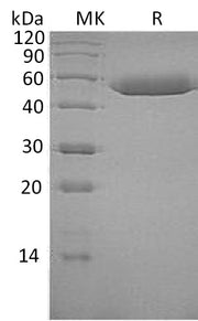 Recombinant Human Serpin F1 (C-6His)
