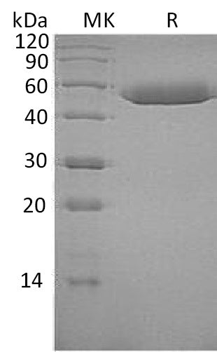 Recombinant Human Serpin F1 (C-6His)