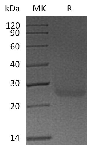 Recombinant Human PDPN (C-6His)