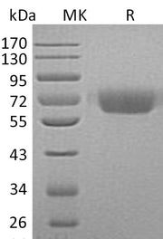 Recombinant Human KNG1 (C-6His)