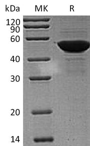 Recombinant Human PDIA6 (C-6His)