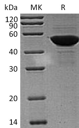Recombinant Human PDIA6 (C-6His)