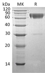 Recombinant Human Serpin A3 (C-6His)