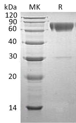 Recombinant Human Serpin A3 (C-6His)