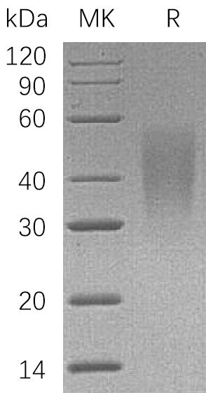 Recombinant Human CD58 (C-6His)