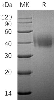 Recombinant Human SLAMF7 (C-6His)