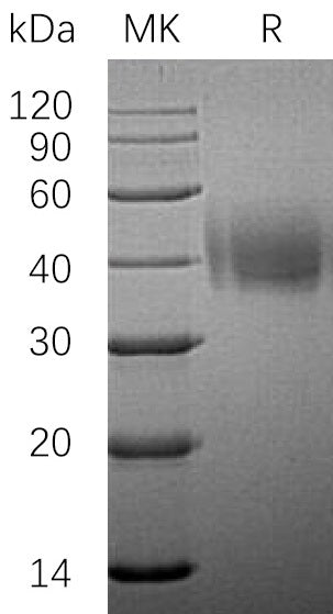 Recombinant Human SLAMF7 (C-6His)