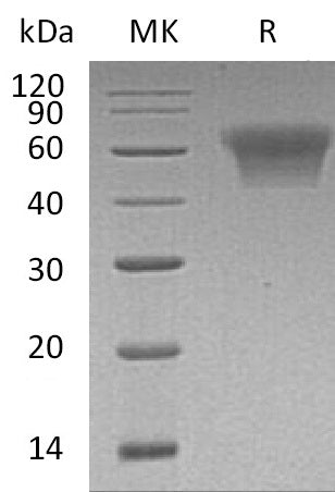 Recombinant Human CD55 (C-6His)