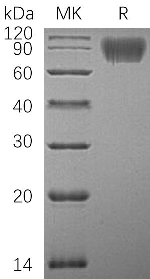 Recombinant Human ICAM-1 (C-6His)