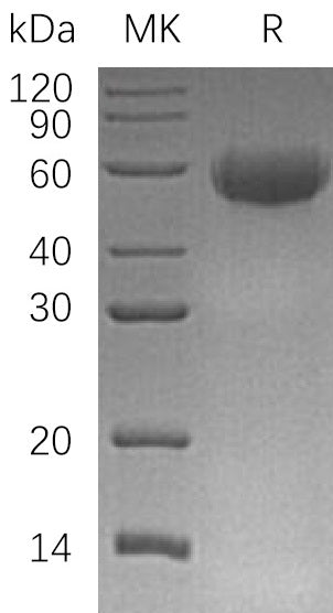 Recombinant Human CD46 (C-6His)
