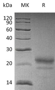 Recombinant Human CST7 (C-6His)
